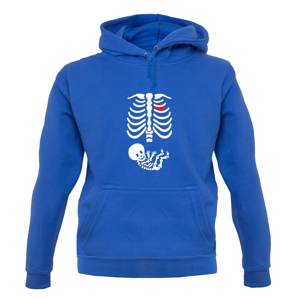 Skeleton Baby Boy unisex hoodie Skeleton Baby Boy unisex hoodie